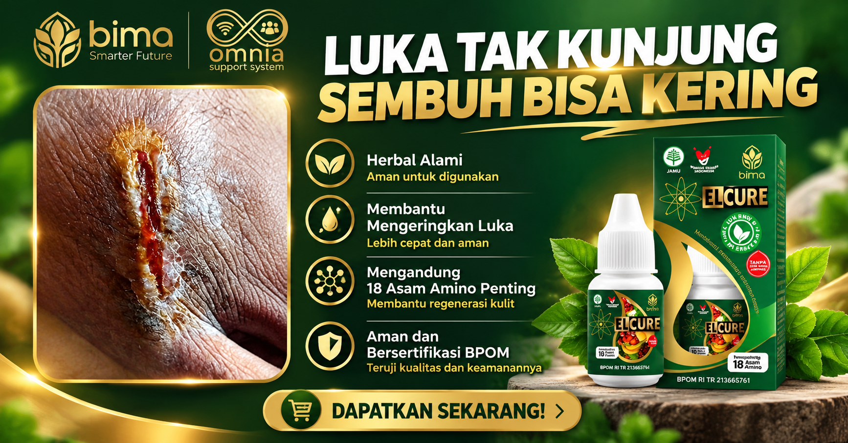 Luka tak Kunjung Sembuh, Bisa Kering dengan Elcure