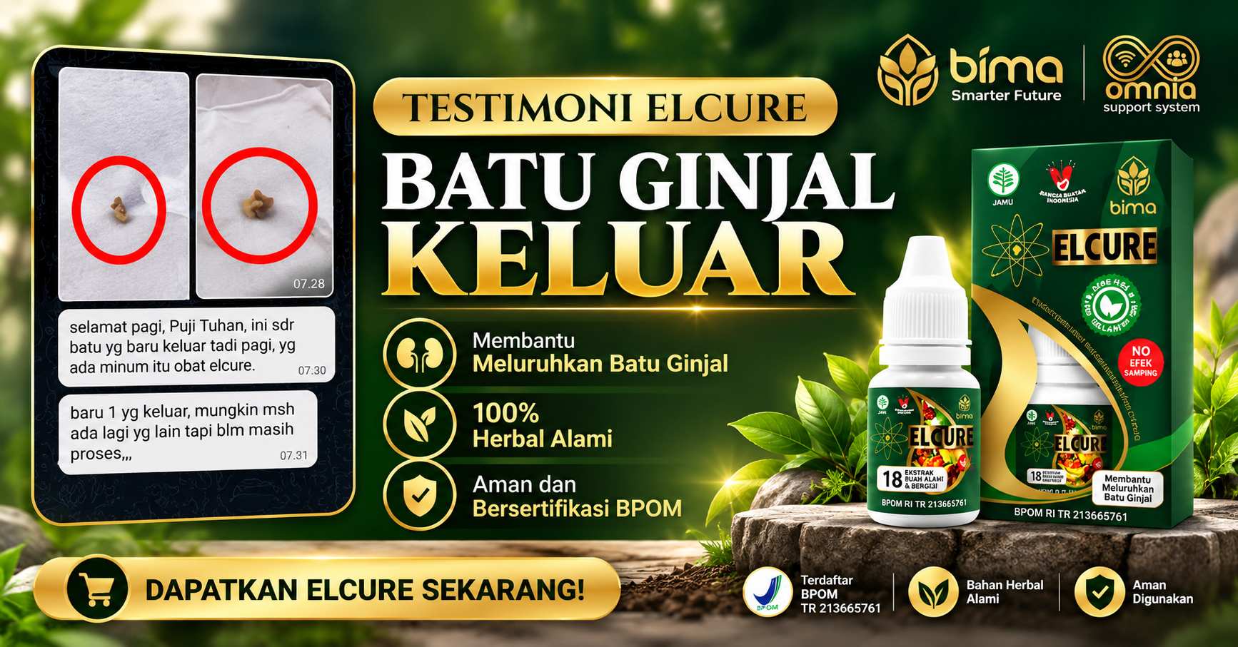 Batu Ginjal Keluar dengan Elcure