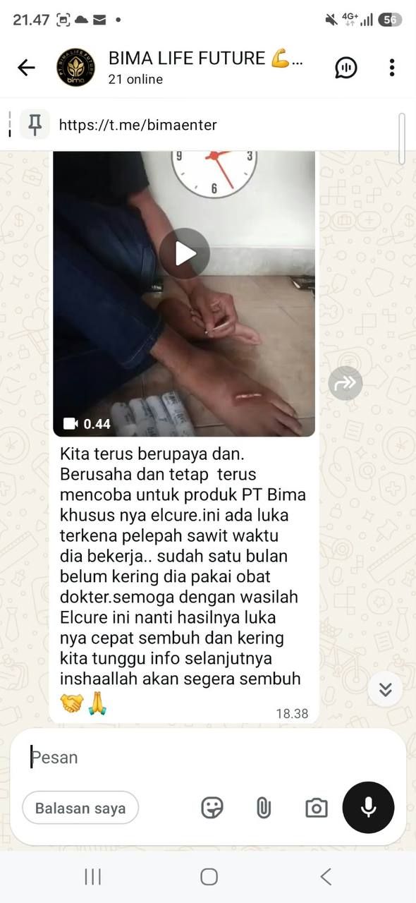 Proses pertama kali dioleskan Elcure, luka menganga tidak pernah kering