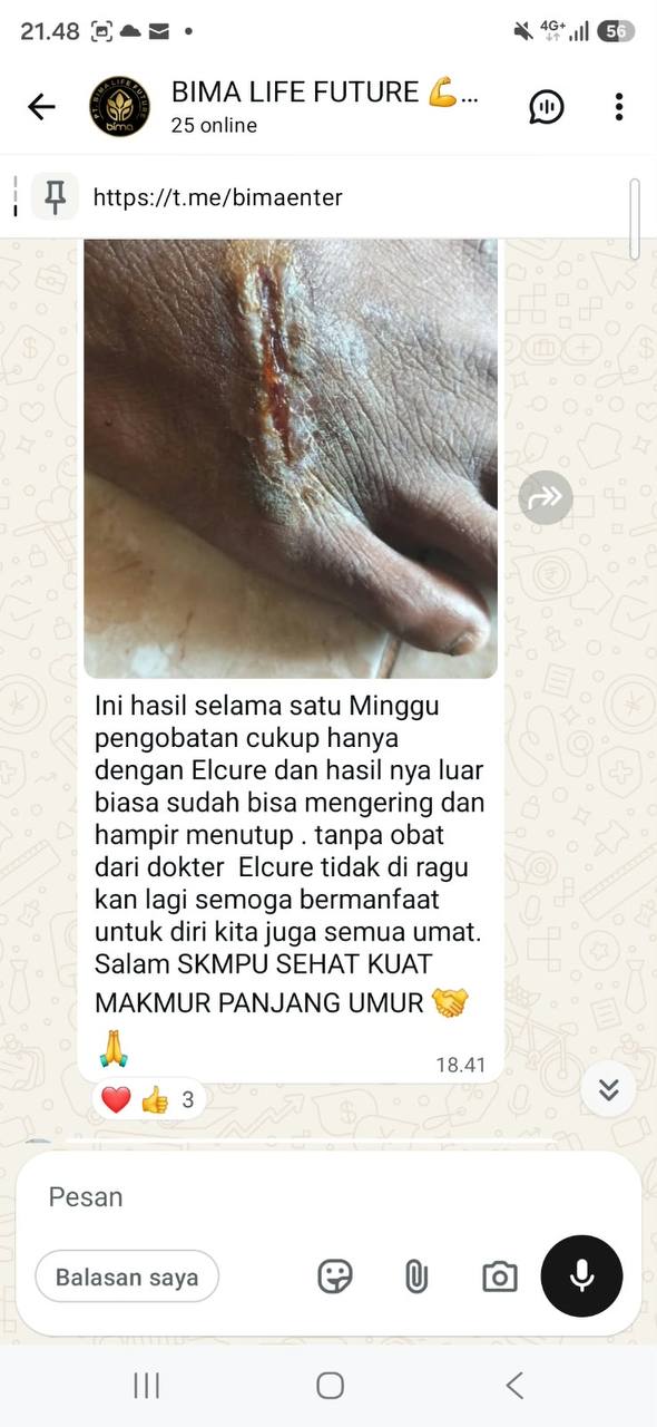 Setelah 1 minggu pakai Elcure, luka mengering dan mulai sembuh