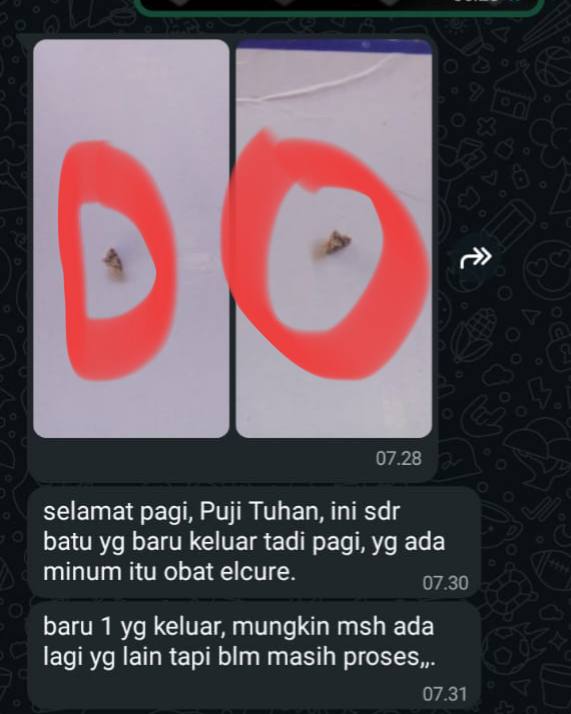 Screenshot testimoni langsung pasien batu ginjal keluar setelah konsumsi Elcure